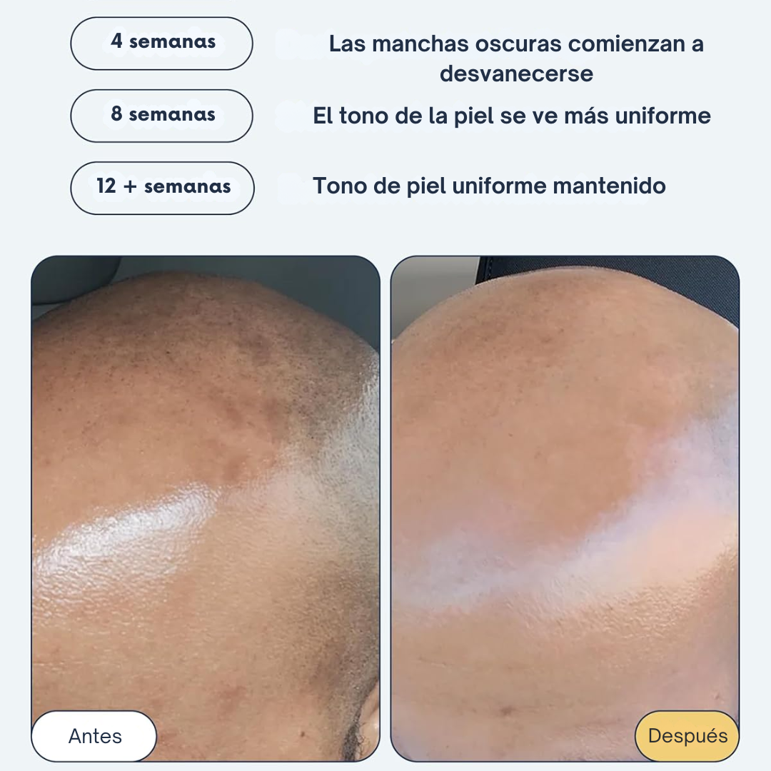 Serum Corrector de Manchas Oscuras Multiacción®