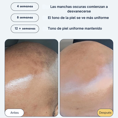 Serum Corrector de Manchas Oscuras Multiacción®