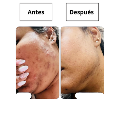 Serum Corrector de Manchas Oscuras Multiacción®