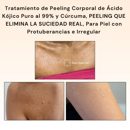Spray Exfoliante Corporal Avanzado para Piel Radiante®