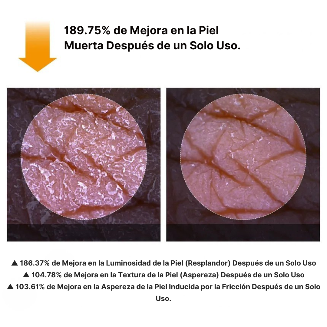 Spray Exfoliante Corporal Avanzado para Piel Radiante®