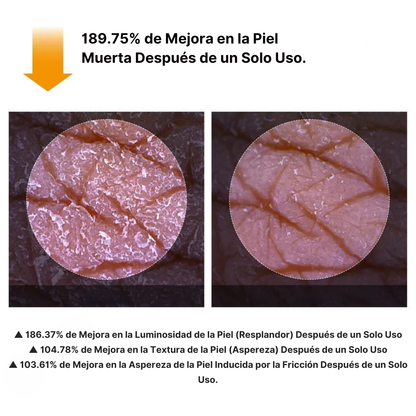 Spray Exfoliante Corporal Avanzado para Piel Radiante®